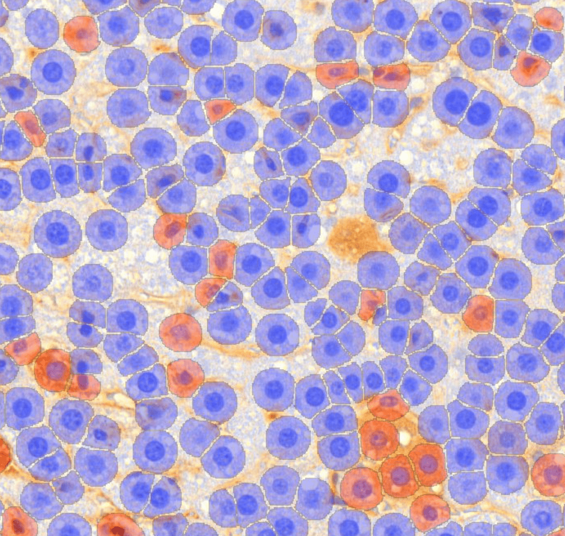 Quantitative IHC Image Analysis Preclinical CRO Services